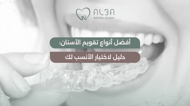 انواع تقويم الأسنان