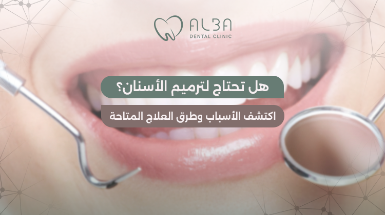 ترميم الأسنان