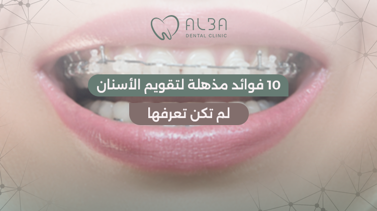 فوائد تقويم الاسنان