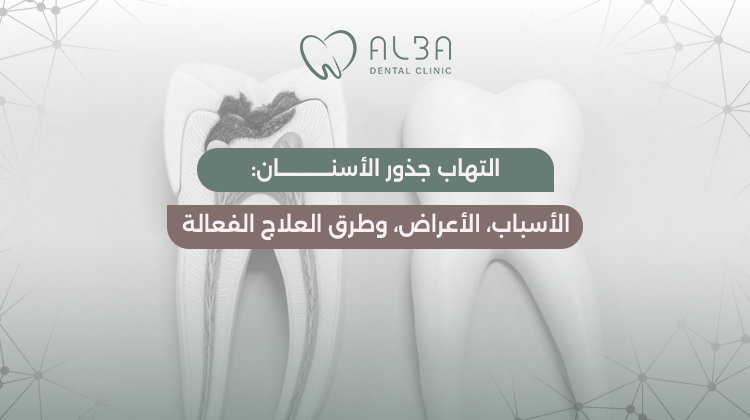 التهاب جذور الأسنان