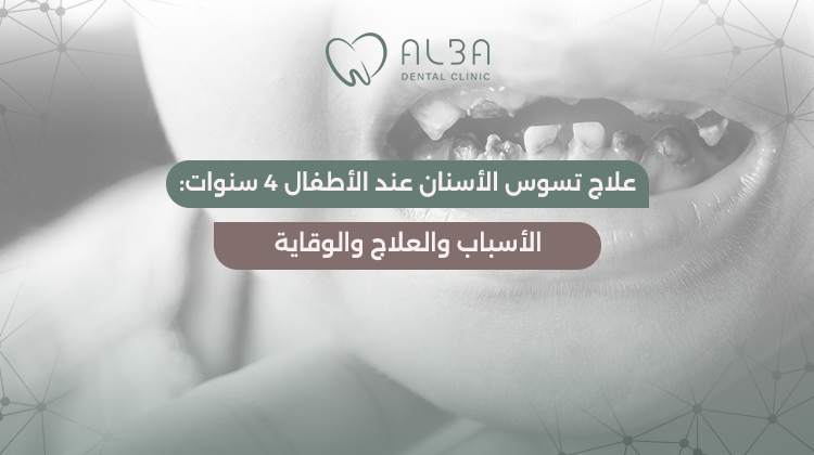 علاج تسوس الأسنان عند الأطفال 4 سنوات