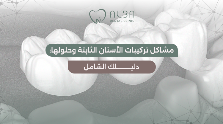 مشاكل تركيبات الاسنان الثابتة
