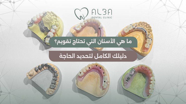 الاسنان التي تحتاج تقويم