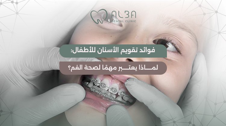 فوائد تقويم الاسنان للاطفال