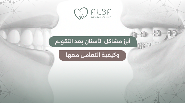 مشاكل الاسنان بعد التقويم