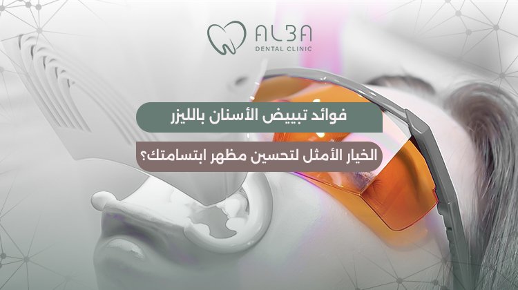 فوائد تبييض الأسنان بالليزر