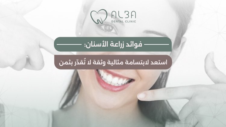 فوائد زراعة الاسنان