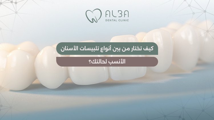 انواع تلبيسات الاسنان