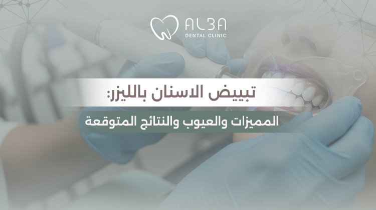 تبييض الاسنان بالليزر: المميزات والعيوب والنتائج المتوقعة | عيادة البا