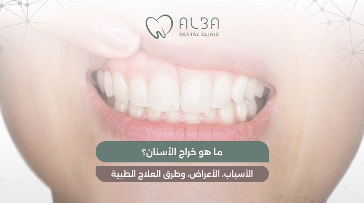 ما هو خراج الاسنان؟ الأسباب، الأعراض، وطرق العلاج الطبية