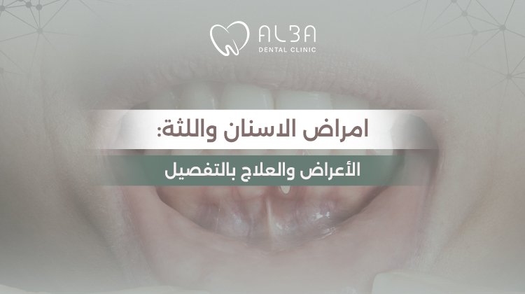 امراض الاسنان واللثة: الأعراض والعلاج بالتفصيل