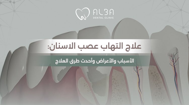 علاج التهاب عصب الأسنان: الأسباب والأعراض وأحدث طرق العلاج