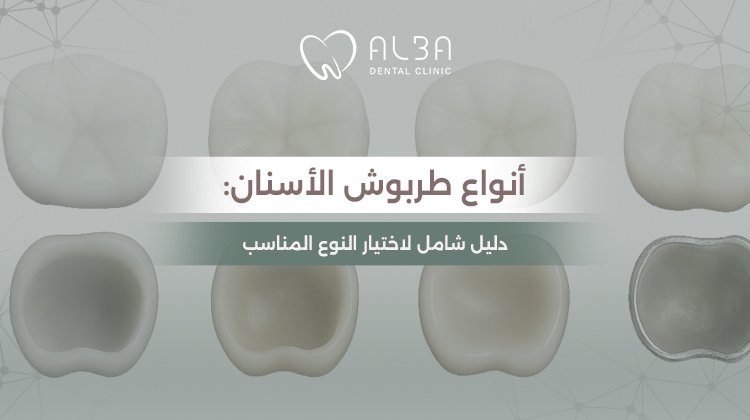 أنواع طربوش الأسنان