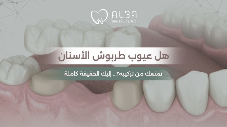 عيوب طربوش الأسنان