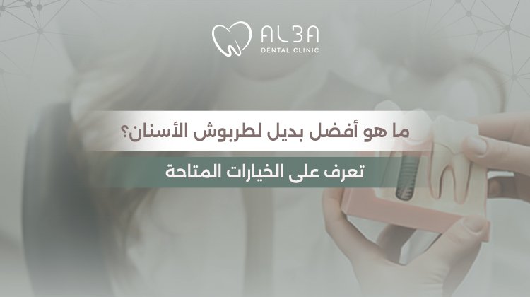 ما هو أفضل بديل طربوش الاسنان؟ تعرف على الخيارات المتاحة