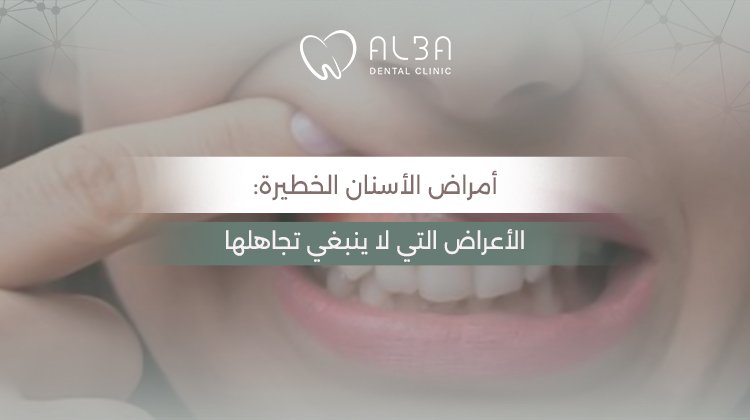أمراض الأسنان الخطيرة: الأعراض التي لا ينبغي تجاهلها