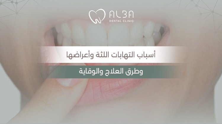 اسباب التهابات اللثة: الأعراض والعوامل المؤثرة وطرق العلاج