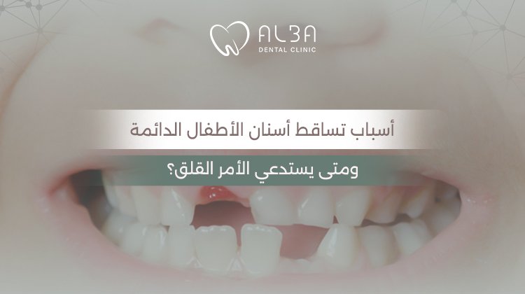 أسباب تساقط أسنان الأطفال الدائمة ومتى يستدعي الأمر القلق؟