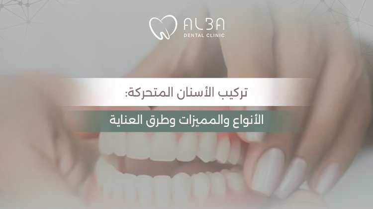 تركيب الأسنان المتحركة: الأنواع والمميزات وطرق العناية